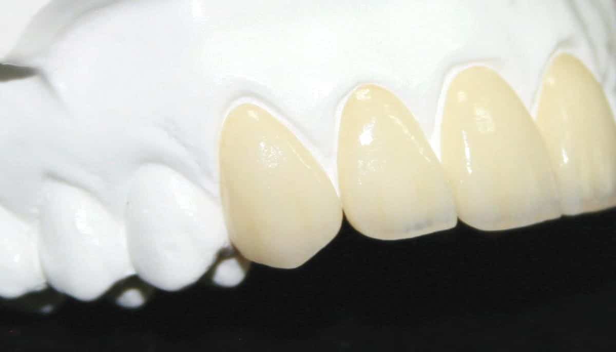 Zirconia Dental Laboratory Pic