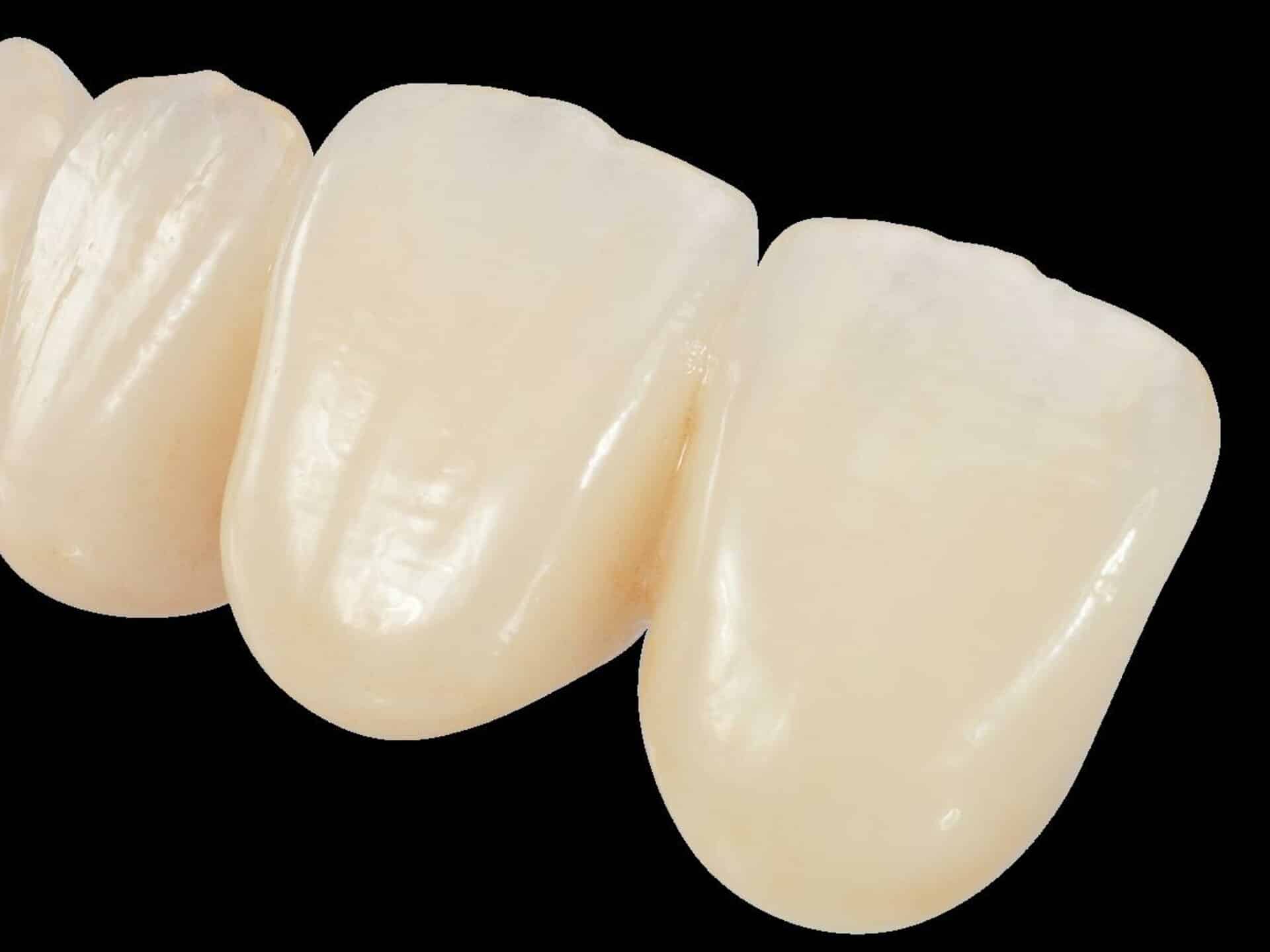 ZirCAD cosmetic dental lab Emax cosmetic dental lab image