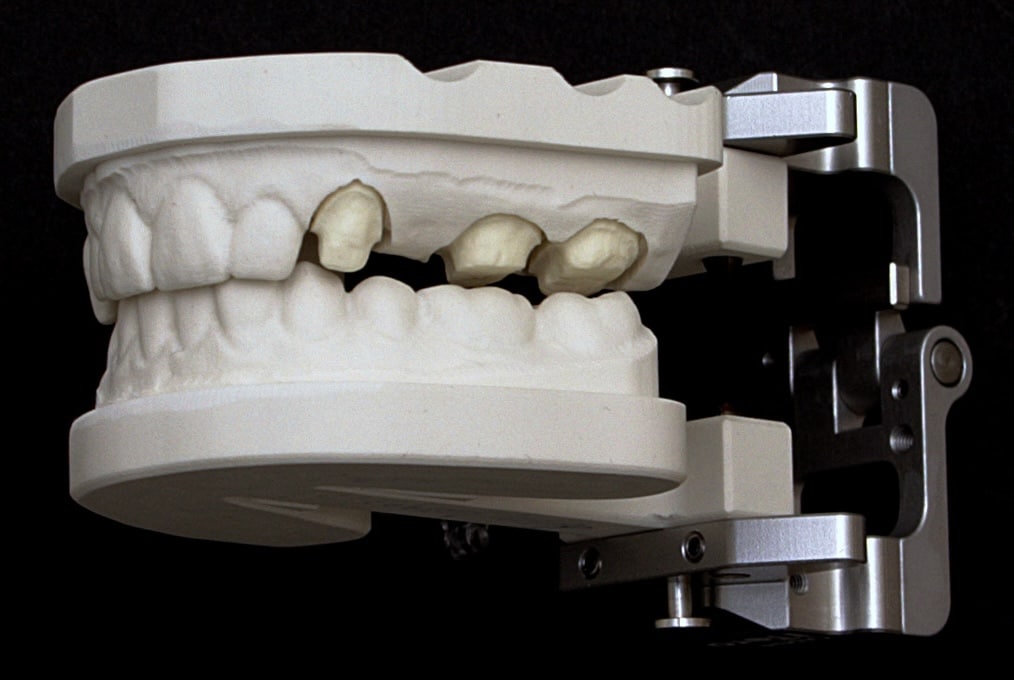 3Dmodel iTero Lab 3D Model