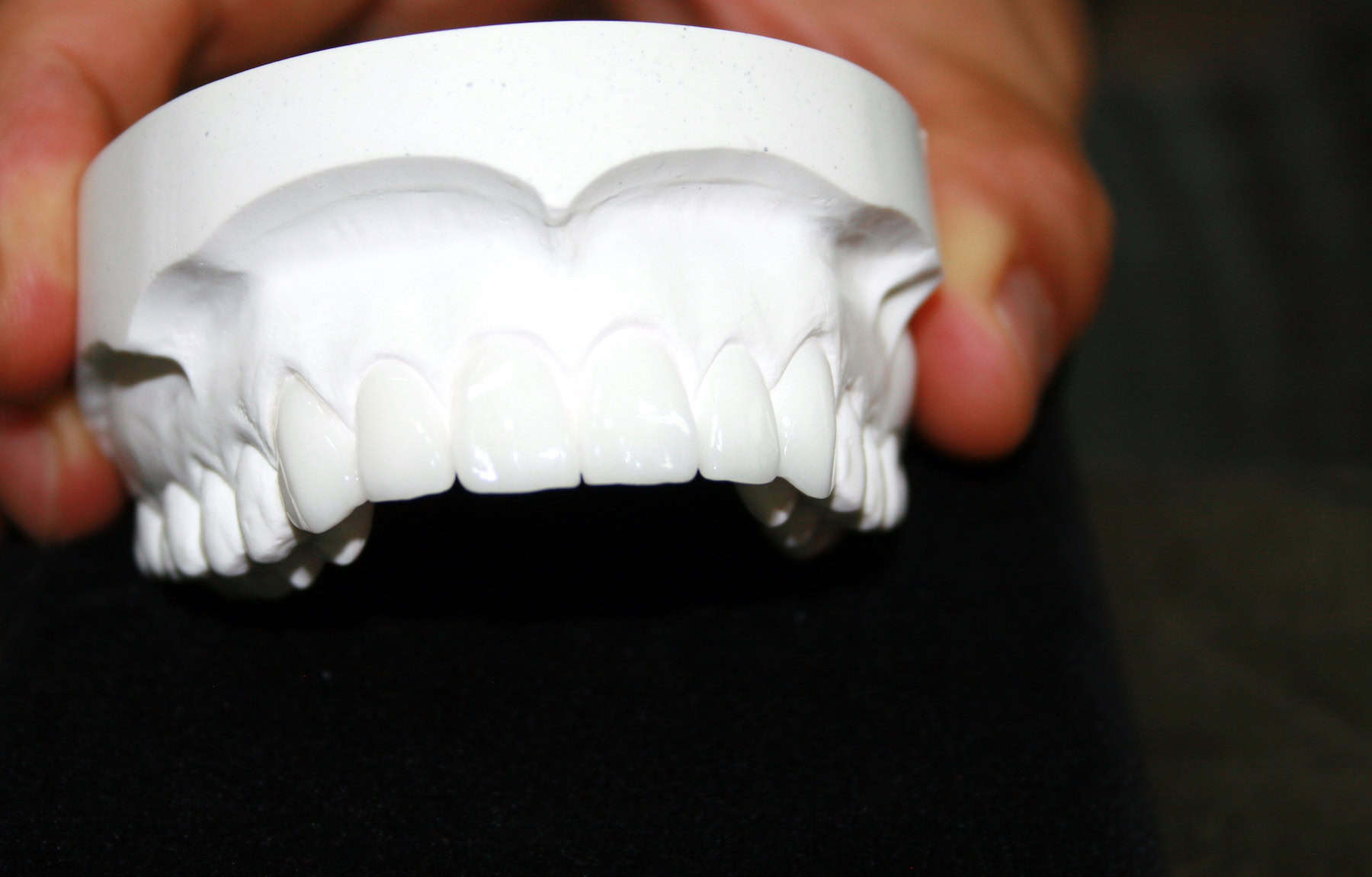 Diagnostic Wax Up Image Diagnostic wax-up model used for cosmetic dentistry treatment planning and dental laboratory case design